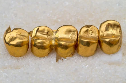зубные протезы из золота